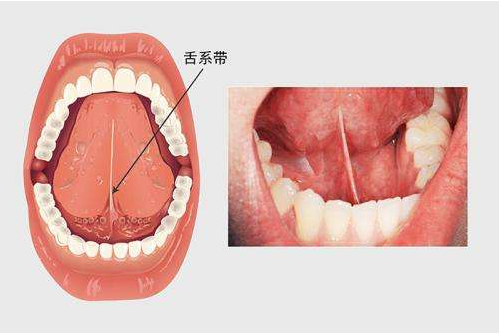 QQ截图20180426130306.png